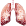 Lung Cancer